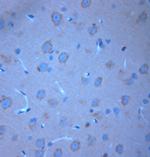 Syntaxin6 Antibody in Immunohistochemistry (Paraffin) (IHC (P))