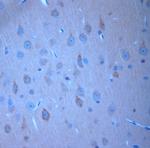 Syntaxin6 Antibody in Immunohistochemistry (Paraffin) (IHC (P))