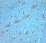 Synaptotagmin 1 Antibody in Immunohistochemistry (Paraffin) (IHC (P))