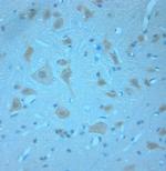 Synaptotagmin 1 Antibody in Immunohistochemistry (Paraffin) (IHC (P))