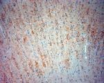 Synaptotagmin 2 Antibody in Immunohistochemistry (Paraffin) (IHC (P))