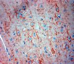 Synaptotagmin 2 Antibody in Immunohistochemistry (Paraffin) (IHC (P))