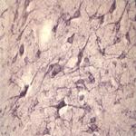 Sortilin Antibody in Immunohistochemistry (IHC)