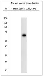 STXB1 Antibody in Western Blot (WB)