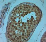 Nav1.8 Antibody in Immunohistochemistry (Paraffin) (IHC (P))