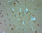 Nav1.8 Antibody in Immunohistochemistry (Paraffin) (IHC (P))