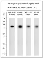 STIM1 Antibody in Western Blot (WB)