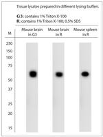 5HT1B R Antibody in Western Blot (WB)