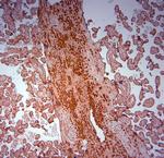 SRD5A2 Antibody in Immunohistochemistry (Paraffin) (IHC (P))