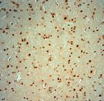 Striatin 4 Antibody in Immunohistochemistry (Paraffin) (IHC (P))