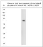 SLC22A8 Antibody in Western Blot (WB)