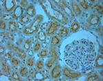 SLC6A8 Antibody in Immunohistochemistry (Paraffin) (IHC (P))