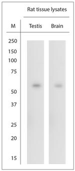 SRF Antibody in Western Blot (WB)