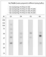 SNTB1 Antibody in Western Blot (WB)