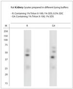 SNTB1 Antibody in Western Blot (WB)