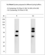 SNTB1 Antibody in Western Blot (WB)