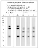 SNTB1 Antibody in Western Blot (WB)