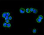 TRPM4 Antibody in Immunocytochemistry (ICC/IF)