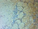 TRPM7 Antibody in Immunohistochemistry (Paraffin) (IHC (P))