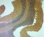 TRPM7 Antibody in Immunohistochemistry (Paraffin) (IHC (P))