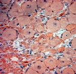 TrkB Antibody in Immunohistochemistry (Paraffin) (IHC (P))