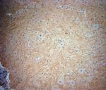 TrkB Antibody in Immunohistochemistry (Paraffin) (IHC (P))