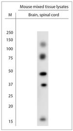 TrkB Antibody in Western Blot (WB)