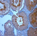 TRPM8 Antibody in Immunohistochemistry (Paraffin) (IHC (P))