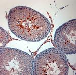 TRPM8 Antibody in Immunohistochemistry (Paraffin) (IHC (P))