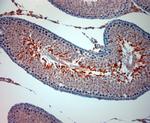 TRPM8 Antibody in Immunohistochemistry (Paraffin) (IHC (P))