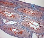 TRPM8 Antibody in Immunohistochemistry (Paraffin) (IHC (P))