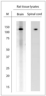 TRPC6 Antibody in Western Blot (WB)