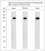 TRPC3 Antibody in Western Blot (WB)