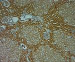 TPC1 Antibody in Immunohistochemistry (Paraffin) (IHC (P))