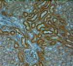 TPC1 Antibody in Immunohistochemistry (Paraffin) (IHC (P))