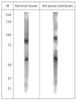 TPC1 Antibody in Western Blot (WB)