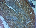 TrkC Antibody in Immunohistochemistry (Paraffin) (IHC (P))