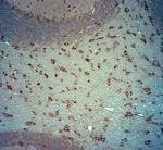 TRPM4 Antibody in Immunohistochemistry (Paraffin) (IHC (P))