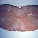 TRPM4 Antibody in Immunohistochemistry (Paraffin) (IHC (P))