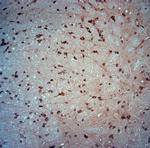 TRPM4 Antibody in Immunohistochemistry (Paraffin) (IHC (P))