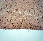 TRPM4 Antibody in Immunohistochemistry (Paraffin) (IHC (P))