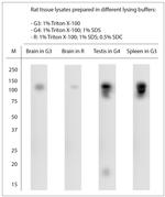 TRPM4 Antibody in Western Blot (WB)