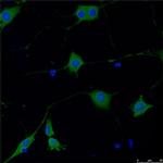 Tyrosine Hydroxylase Antibody in Immunocytochemistry (ICC/IF)