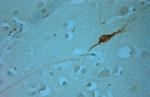 Tyrosine Hydroxylase Antibody in Immunohistochemistry (Paraffin) (IHC (P))