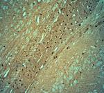 Tau Antibody in Immunohistochemistry (Paraffin) (IHC (P))