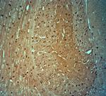 Tau Antibody in Immunohistochemistry (Paraffin) (IHC (P))