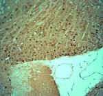 Tau Antibody in Immunohistochemistry (Paraffin) (IHC (P))