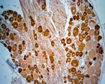 Tau Antibody in Immunohistochemistry (Paraffin) (IHC (P))