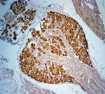 Tau Antibody in Immunohistochemistry (Paraffin) (IHC (P))