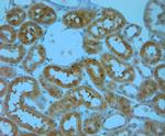 IP3R 1 Antibody in Immunohistochemistry (Paraffin) (IHC (P))